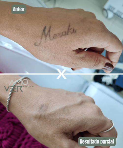 Cópia de Antes - 10