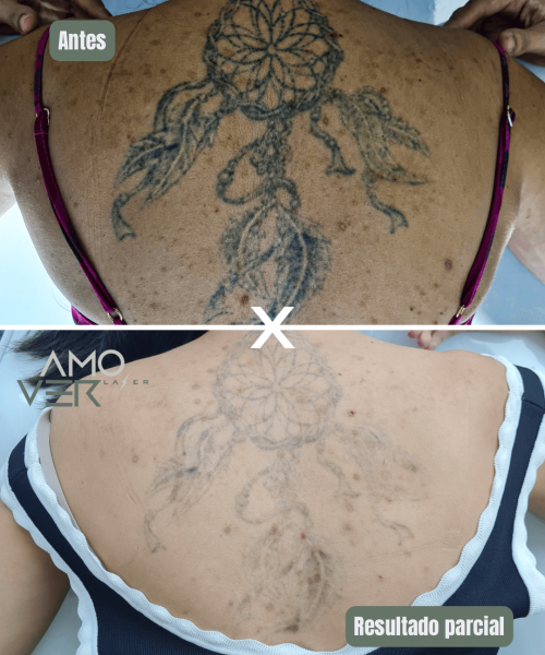 Cópia de Antes - 11