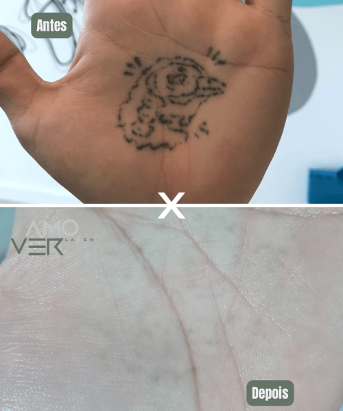 Cópia de Antes - 12