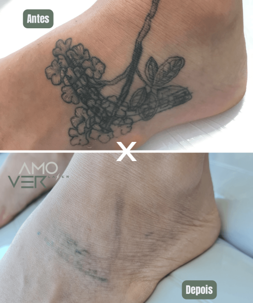 Cópia de Antes - 13