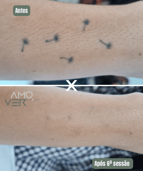 Cópia de Antes - 15