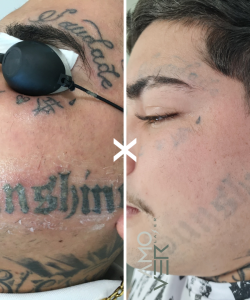 Cópia de Antes - 16