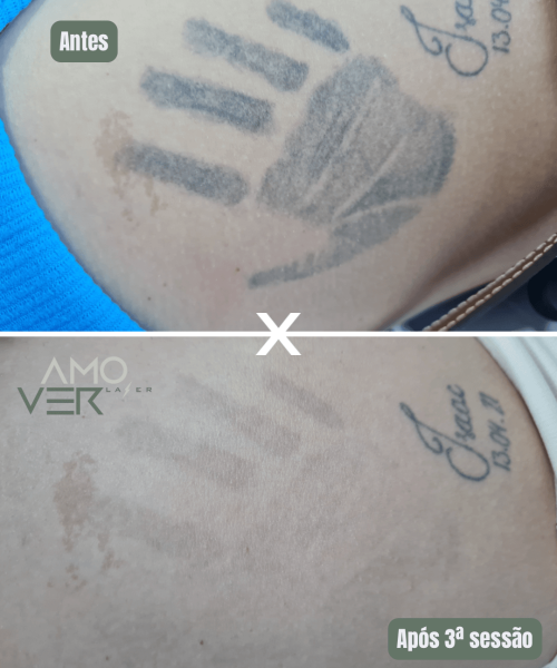 Cópia de Antes - 8